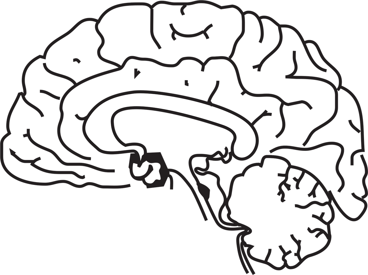 Brain - May Brain